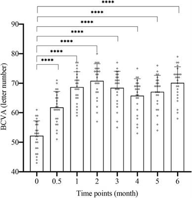 The Efficacy of Simultaneous Injection of Dexamethasone Implant and Ranibizumab Into Vitreous Cavity on Macular Edema Secondary to Central Retinal Vein Occlusion